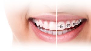 dentistas en Algeciras